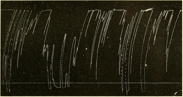 Image from page 355 of "Geriatrics : the diseases of old age and their treatment, including physiological old age, home and institutional care, and medico-legal relations" (1914)